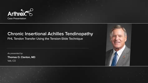 Arthrex - FHL Tendon Transfer