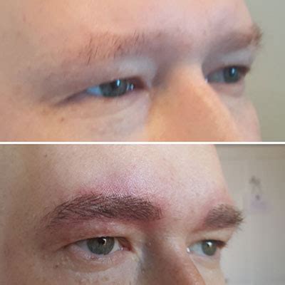 Permanent & Semi-Permanent Makeup - Allure Inclusive Health Clinic