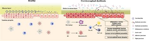 Frontiers | Interactions between microbiota and cervical epithelial, immune, and mucus barrier