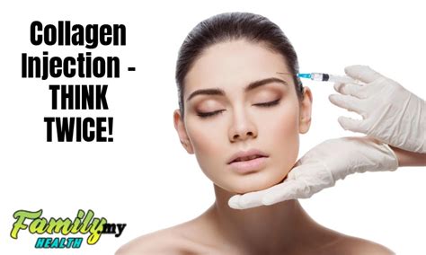 Collagen Injection – THINK TWICE! - Malaysia Health Family medicine and ...