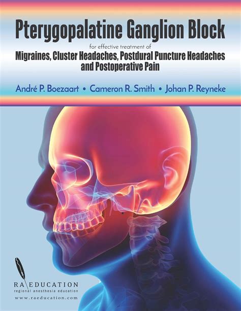 Buy Pterygopalatine Ganglion Block: For Effective of Migraine, Cluster Headache, Postdural ...