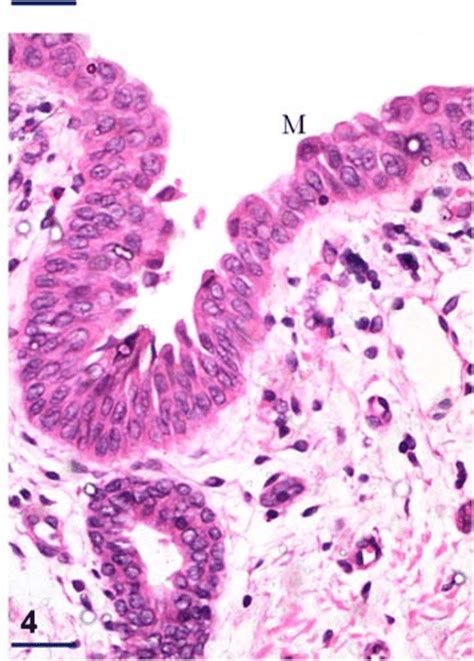 Photomicrograph of the tubal tonsil showing specialised epithelium not... | Download Scientific ...