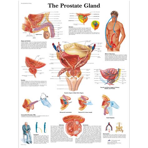 The Prostate Gland chart - SEM Trainers