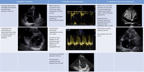 Two-dimensional transthoracic echocardiography at rest for the diagnosis, screening and ...