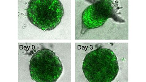 Follow the leader: Researchers identify mechanism of cancer invasion ...