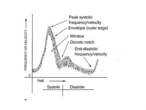 Doppler Ultrasound Physics 3 - YouTube