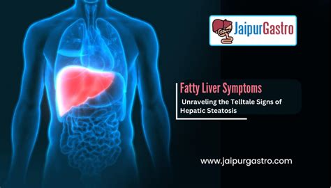 14 Fatty Liver Symptoms - Dr. Shankar Dhaka | Jaipur Gastro