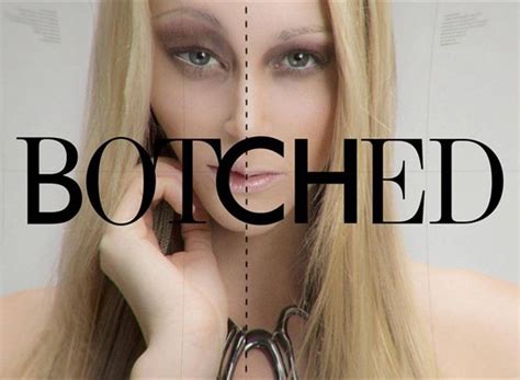 Botched Season 7 Episodes List - Next Episode