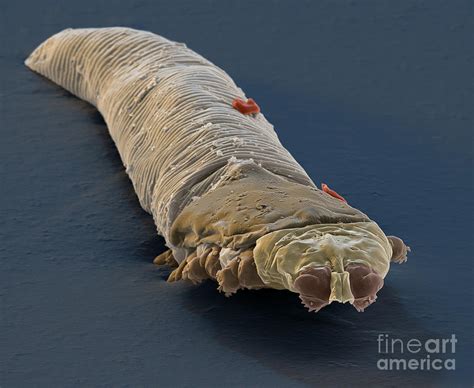 Demodex folliculorum Photograph by Eye of Science - Pixels