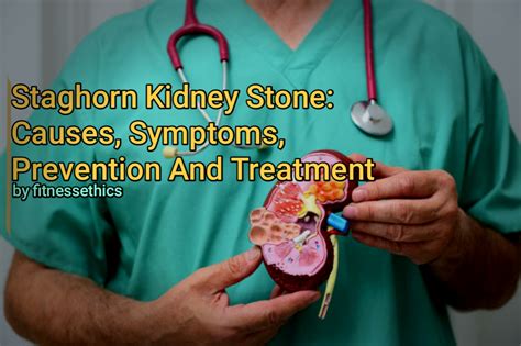 Staghorn Kidney Stone: Causes, Symptoms, Prevention And Treatment - Fitnessethics Blog