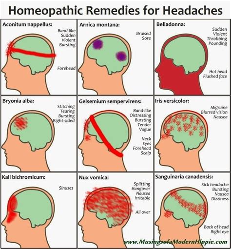 Homeopathy for Headaches | Natural headache remedies, Migraines remedies, Homeopathy