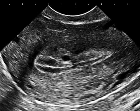 Practice of Ultrasound: Part 9 -- Image quality