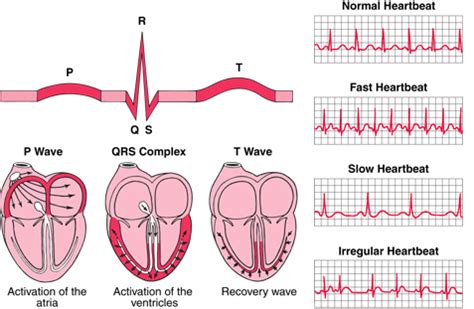 ECG findings and CHD - Seven Countries Study | The first study to relate diet with ...