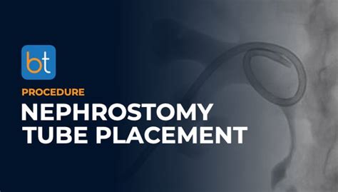 Nephrostomy Tube Placement Procedure | BackTable VI