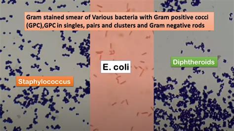 Staphylococcus, E coli and Diphtheroids in Gram stained smear of culture - YouTube