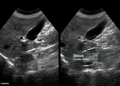 Ultrasound Examination Of Human Internal Organs Stock Photo - Download ...