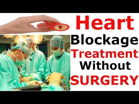 Heart blockage treatment without surgery | Natural Home Remdies As ...