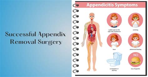 Appendix Removal Surgery - Costs and Symptoms of Appendicitis