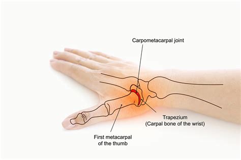 Carpometacarpal Joint Anatomy