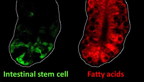 Intestinal stem cell genes may link dietary fat and colon cancer