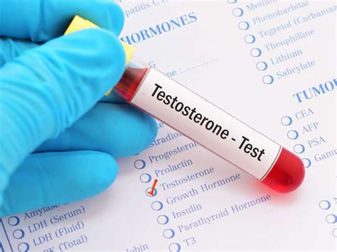 Testosterone Blood Test Results Explained! - By Dr. Azad | Lybrate