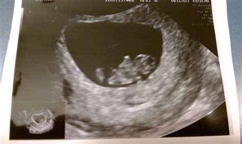 All You Knew Was Love...: 8 week ultrasound and appt