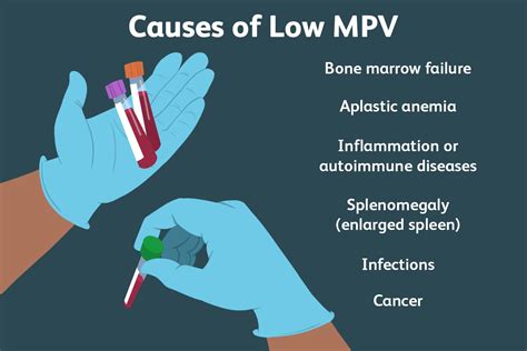 MPV Blood Test: Procedure, Results, And Causes