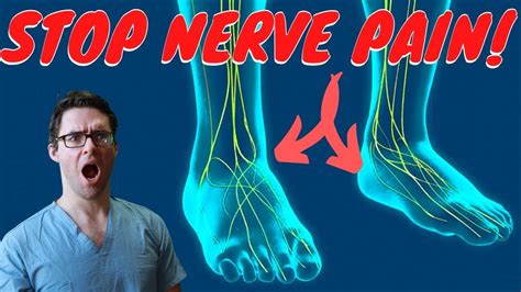 Plantar Nerve Entrapment