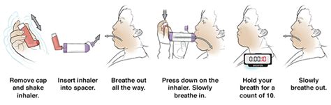 Discharge Instructions: Using a Metered-Dose Inhaler