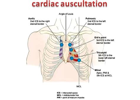 PT Flashcards On Twitter: "#CardiacAssessment101: Auscultation Of The ...