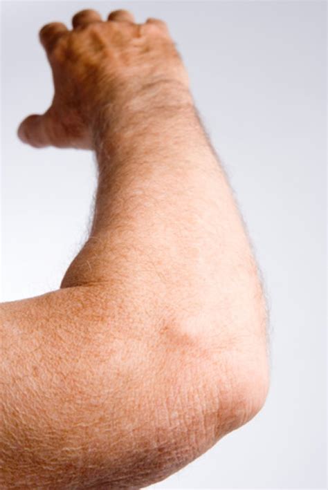 Causes of Painful, Dry Skin on the Elbows | Livestrong.com