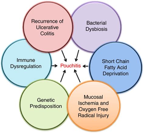 Review article: the pathogenesis of pouchitis - Schieffer - 2016 ...