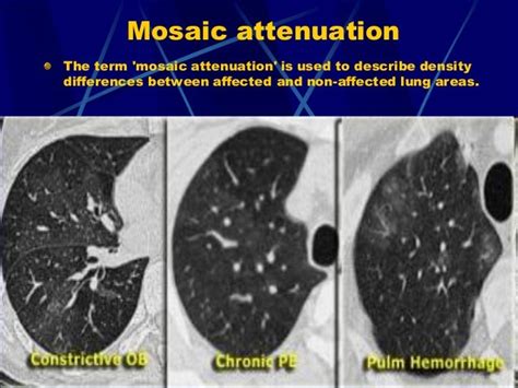 Reticular pattern