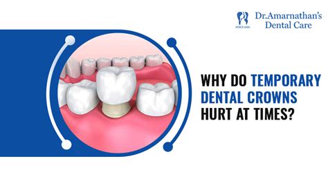 What are the factors behind temporary crown pain?