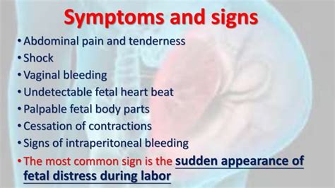 Rupture of the uterus