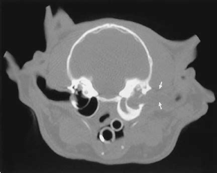 Cat Ear Polyps Surgery