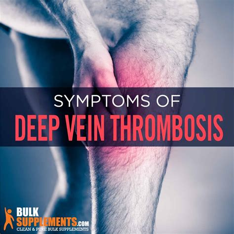 Deep Vein Thrombosis: Symptoms, Causes & Treatment