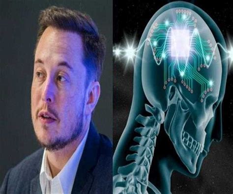 What does Elon Musk Neuralink is all about - MindStick YourViews