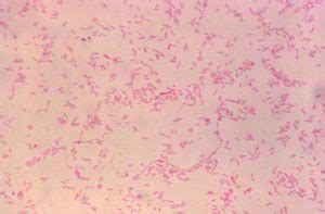 Legionella pneumophila: Properties, Pathogenesis, Lab Diagnosis – Microbe Online