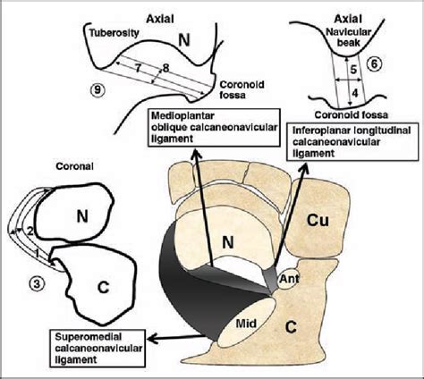 Transverse Tarsal Joint