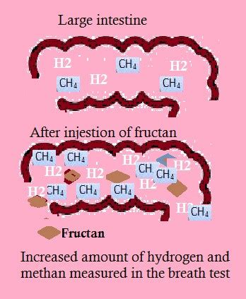 Gluten and Fructan.Wheat doesn't contain only gluten but fructan as well.