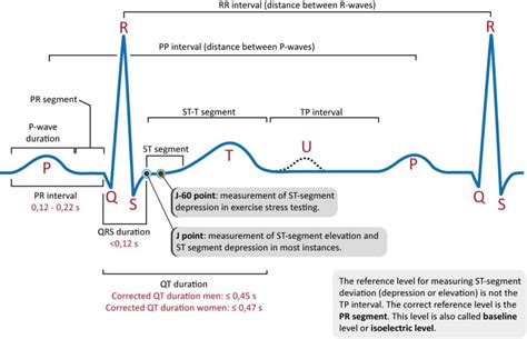 ECG interpretation: Characteristics of the normal ECG (P-wave, QRS complex, ST segment, T… in ...