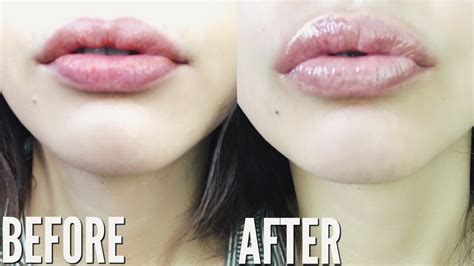 How To Make Your Lips Bigger Permanently Without Injections ...