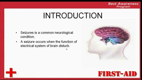 introduction of seizures, what is seizure, definition of seizure ...