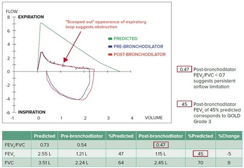 Contemporary Management of Chronic Obstructive Pulmonary Disease | SingHealth