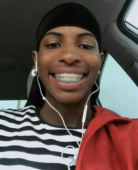 Black Braces On Dark Skin - New Product Critical reviews, Bargains, and ...