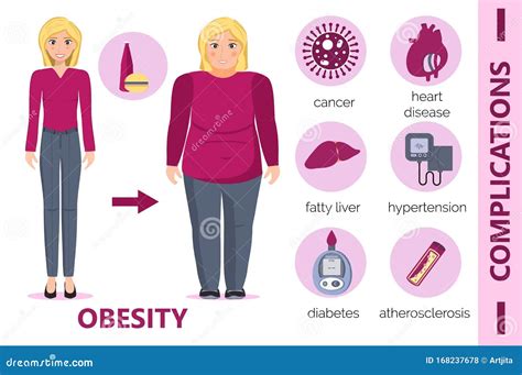 Obesity Complications Infographic for Obsessive Woman. Diabetes ...