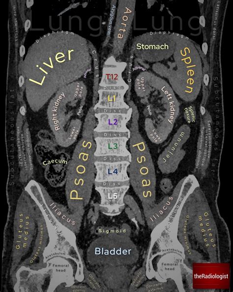 Avraham Z. Cooper, MD on Twitter: "CT abdomen/pelvis coronal anatomy. So helpful. Via ...