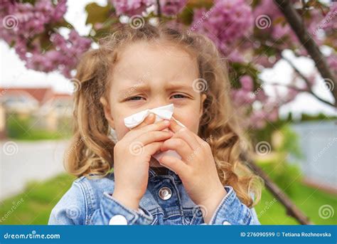 The Child Wipes His Nose with a Napkin. Stock Image - Image of single, sickness: 276090599