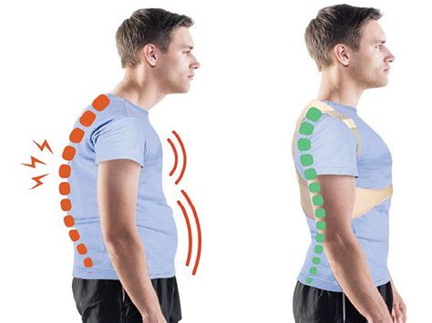 How to choose the perfect Posture Corrector for Men? | Latesco4Happy